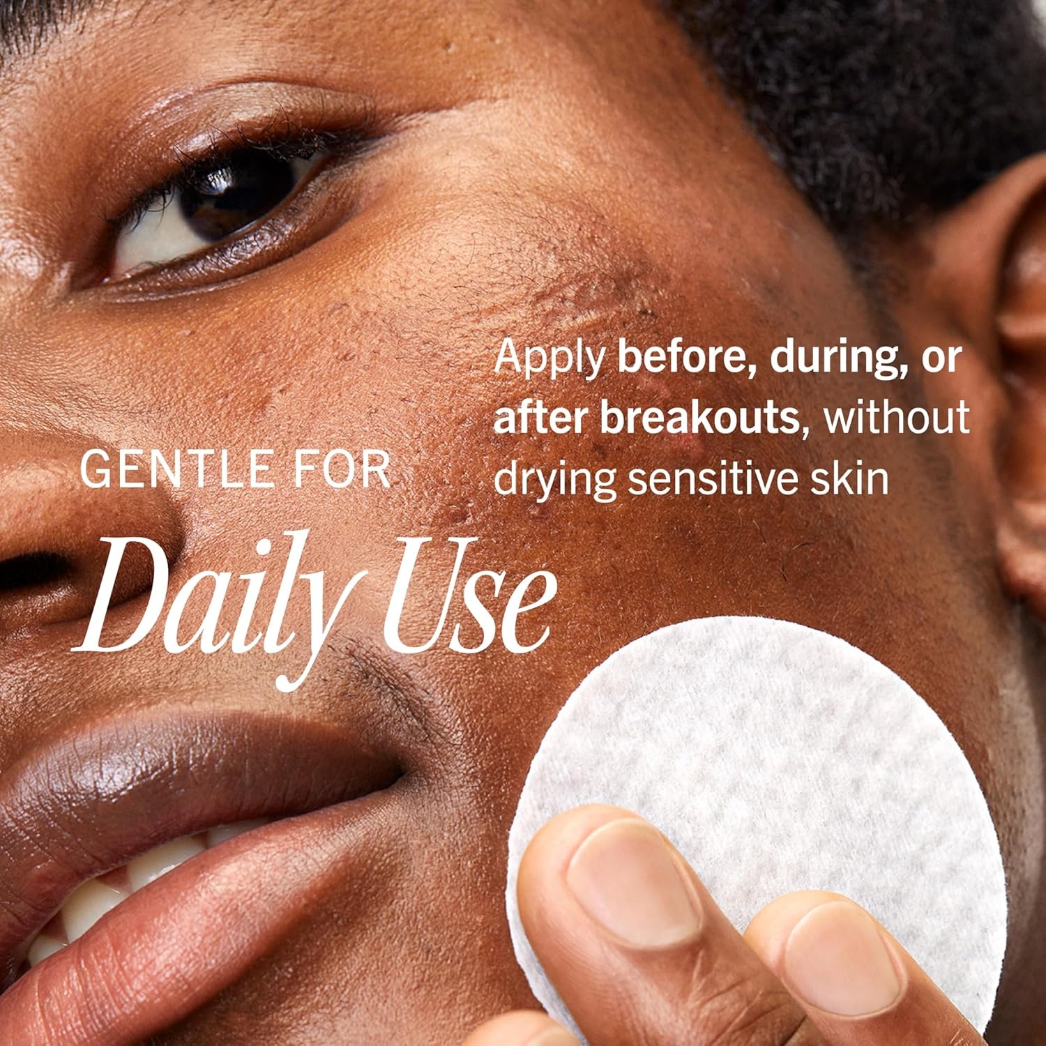 image:imageFirst Aid Beauty Daily Facial Treatment Pads AHA Exfoliating Hydrating Barrier Support amp Salicylic Acid Acne Pads Sensitive Skin Safe60 Count Pack of 1
