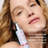 First Aid Beauty – 0.3% Retinol Complex Serum with Peptides, Designed for Sensitive Skin Improve Lines and Wrinkles with Less Irritation than Traditional Retinol, Non-Comedogenic(New)