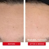 First Aid Beauty – 0.3% Retinol Complex Serum with Peptides, Designed for Sensitive Skin Improve Lines and Wrinkles with Less Irritation than Traditional Retinol, Non-Comedogenic(New)