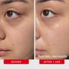 First Aid Beauty – Hydrating Serum with Hyaluronic Acid, Lightweight Formula with Squalane & Colloidal Oatmeal, Safe for Sensitive Skin(New)