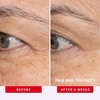 First Aid Beauty – Retinol Eye Cream with Squalane + Ceramides, Encapsulated Retinol Serum for Delicate Skin, Helps Improve Appearance of Fine Lines and Wrinkles(New)