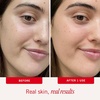 First Aid Beauty – Ultra Repair Face Moisturizer, Soothing Face Colloidal Oatmeal, Non-Comedogenic Formula Helps Soften Skin with Ceramides and Shea Butter(New)