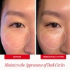 First Aid Beauty Brighten + Glow Eye Cream with Niacinamide, Fragrance Free Dark Circle Eye Cream, Instantly Illuminates & Brightens Under-eye, Sensitive Skin Safe, 0.5 oz