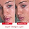 First Aid Beauty Bronze + Glow Drops, 5% Niacinamide Glow Serum, Visibly Blur Pores & Even Skin Tone, Hydrates to Strengthen Moisture Barrier, Non-Comedogenic, 1 oz