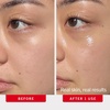 First Aid Beauty – Hydrating Eye Cream with Hyaluronic Acid, Nourishing Eye Cream 24 hours of Hydration, Helps Smooth Fine Lines, Wrinkles & Puffiness(New)