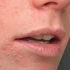 DERMAVIA dermatologist recommended skincare and Skin Barrier Care