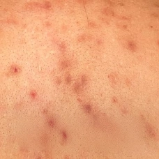 DERMAVIA dermatologist recommended skincare and Skin Barrier Care