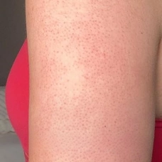 DERMAVIA dermatologist recommended skincare and Skin Barrier Care