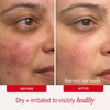 First Aid Beauty Ultra Repair Cream, Intense Hydration(2 Ounce (Pack of 1))
